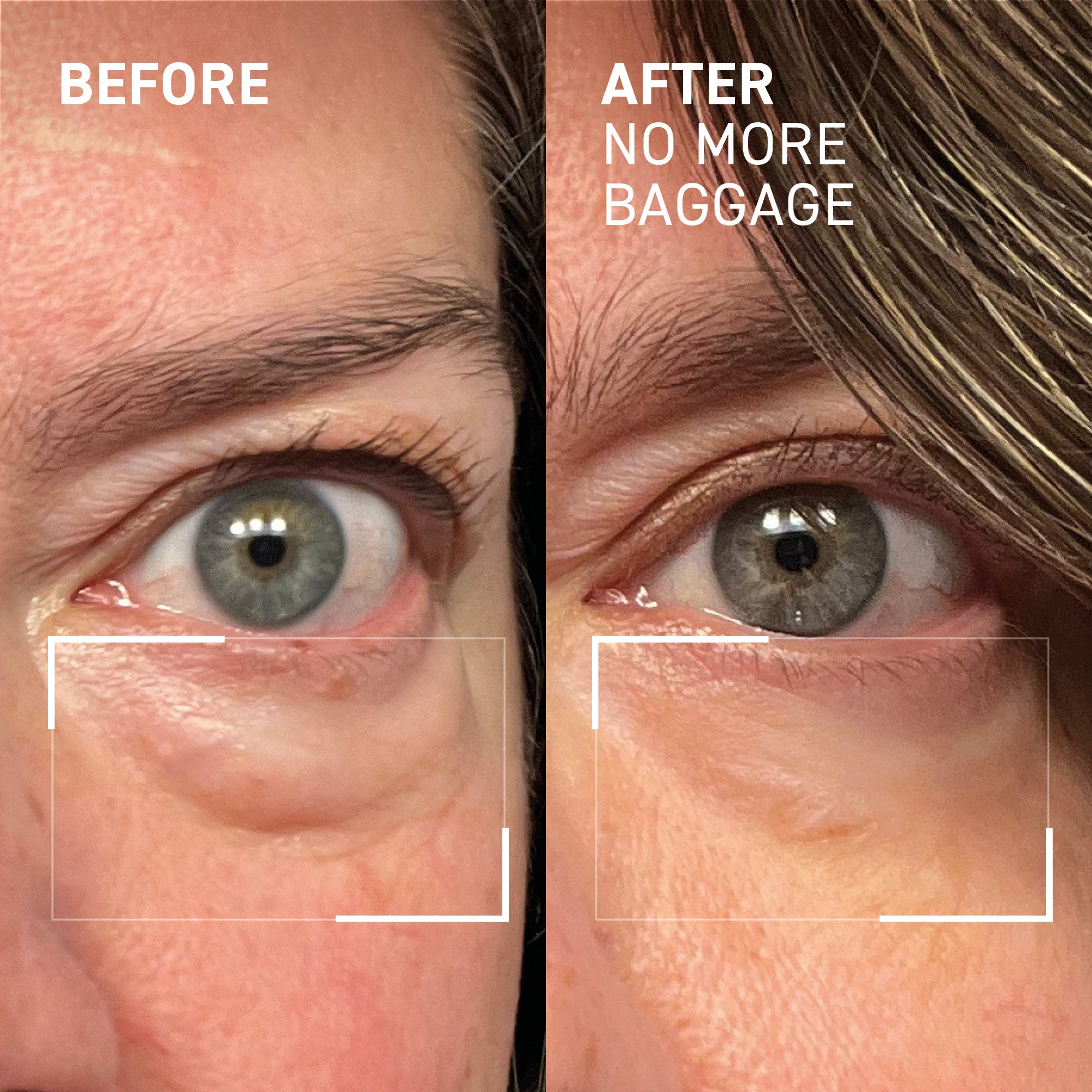 No More Baggage - Jumbo Size