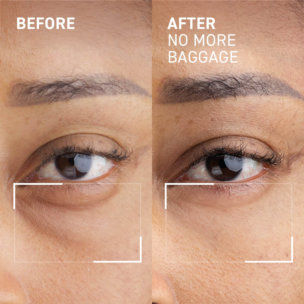 Needles No More No More Baggage Eye Gel 7g