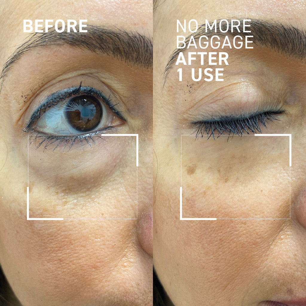 Complexion Booster Kit