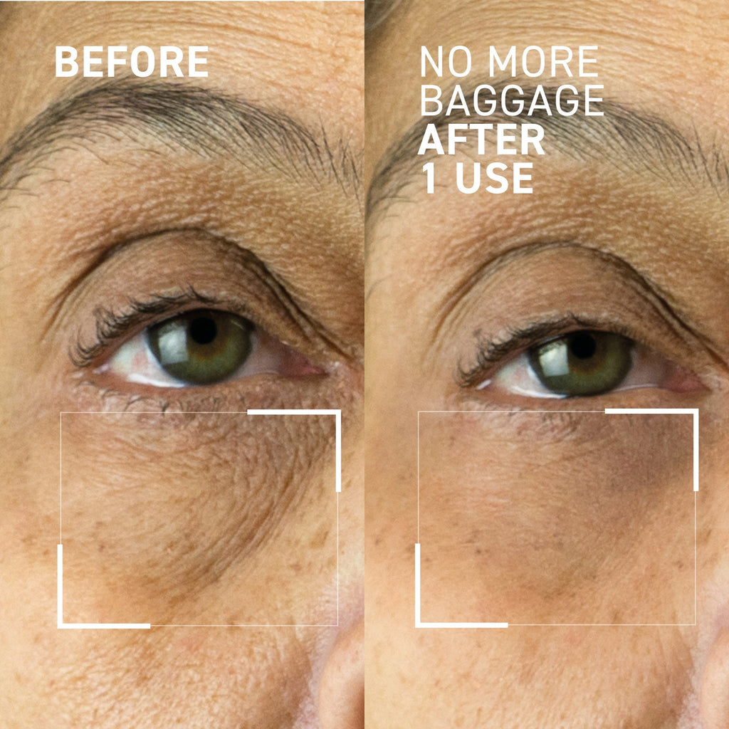 Needles No More No More Baggage Eye Gel 7g