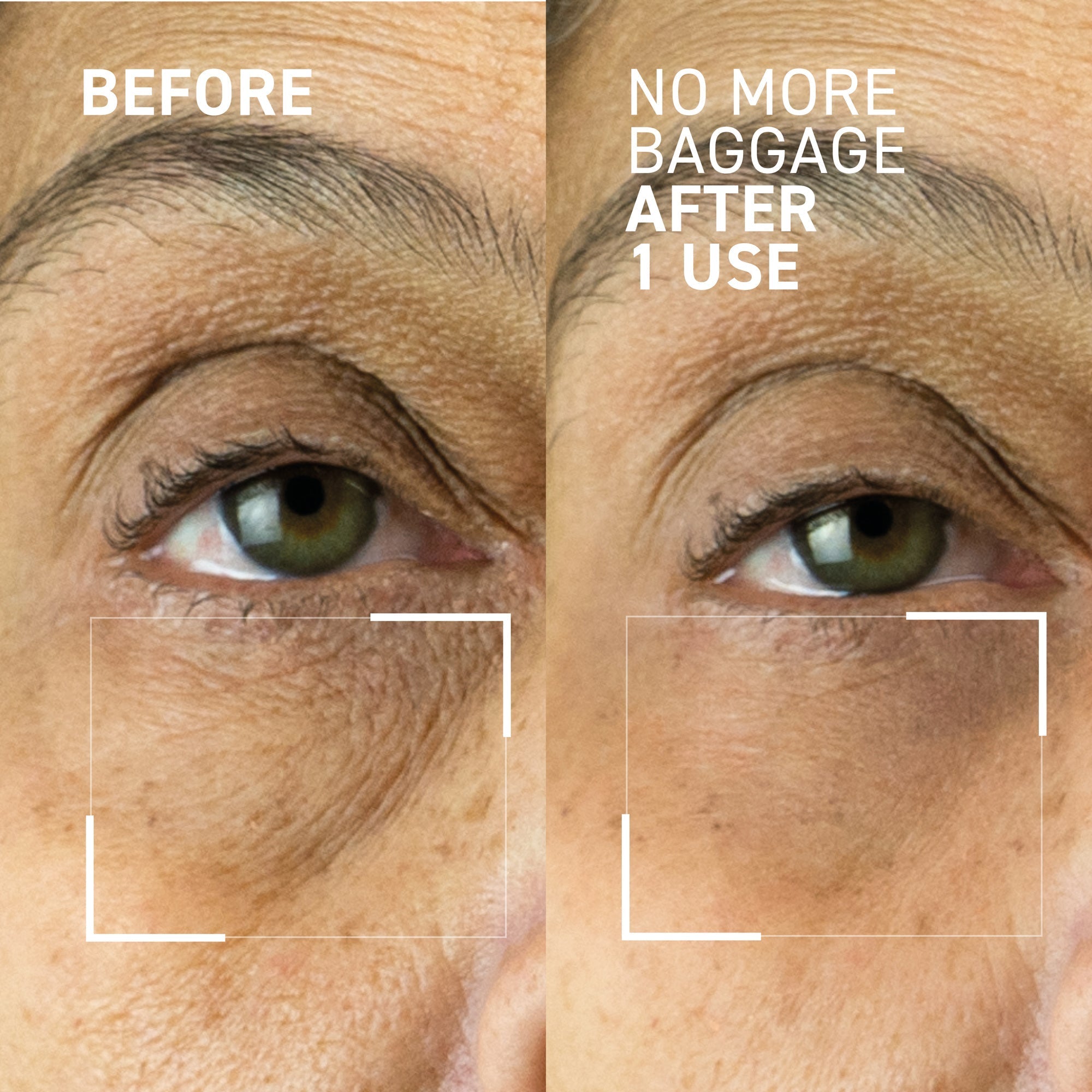Needles No More No More Baggage Eye Gel 7g