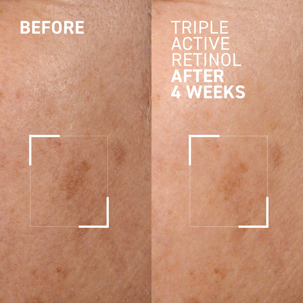 Triple Active Retinol
