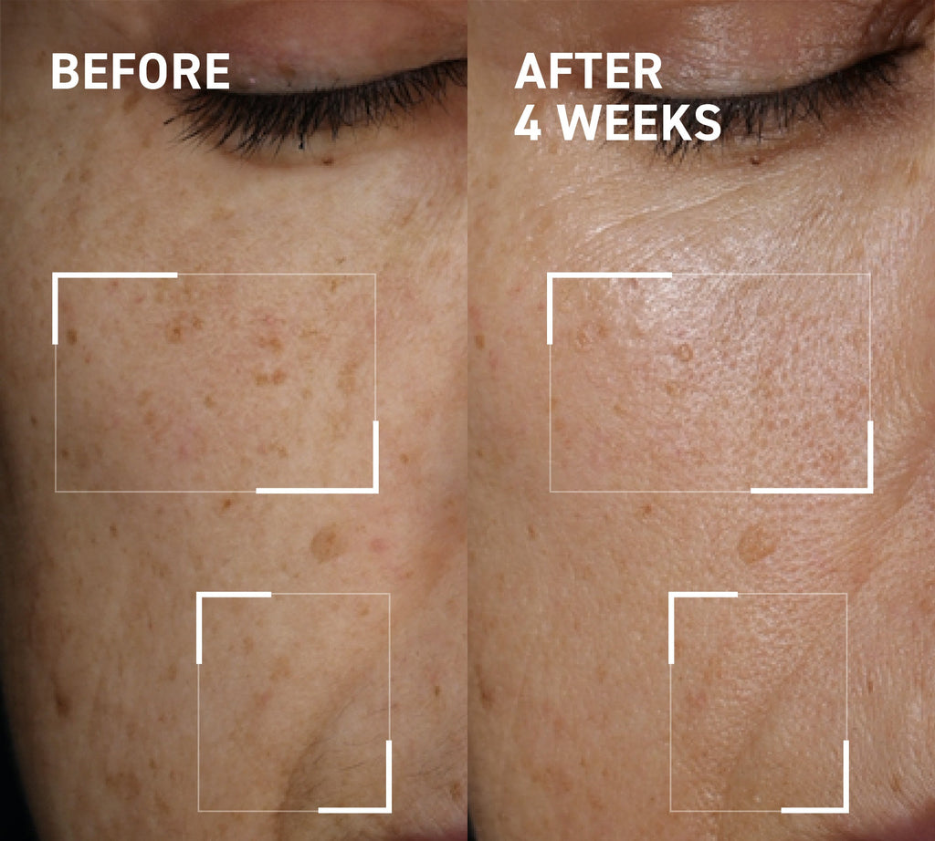 Microneedling Glow Kit