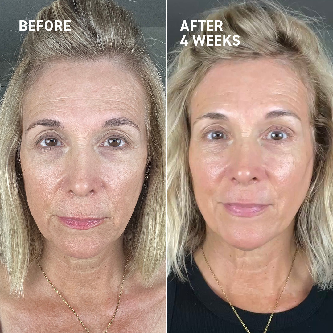 Microneedling Recovery Kit