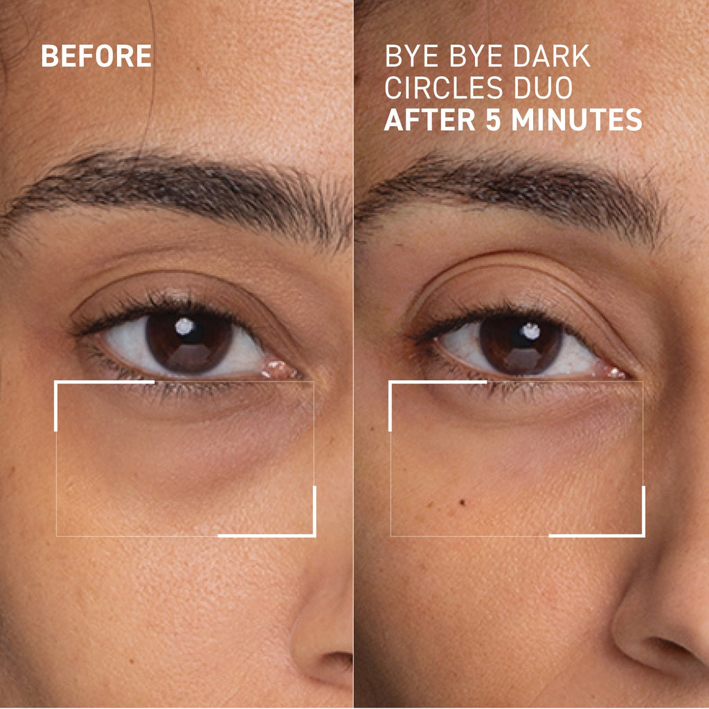 Dark Circles Correcting Eye Duo