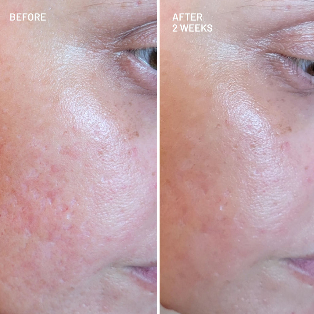 Gentle Radiance Cleansing Duo