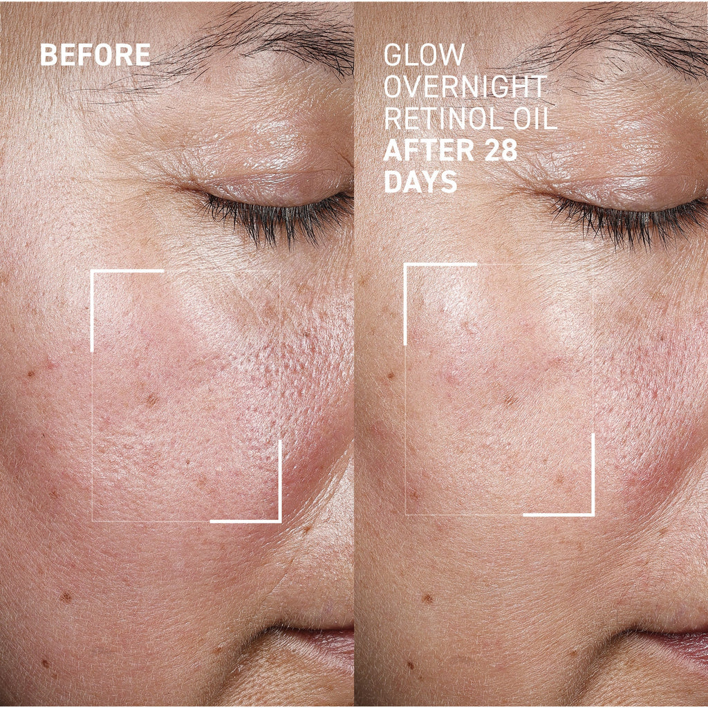 Glow Overnight Retinol Oil