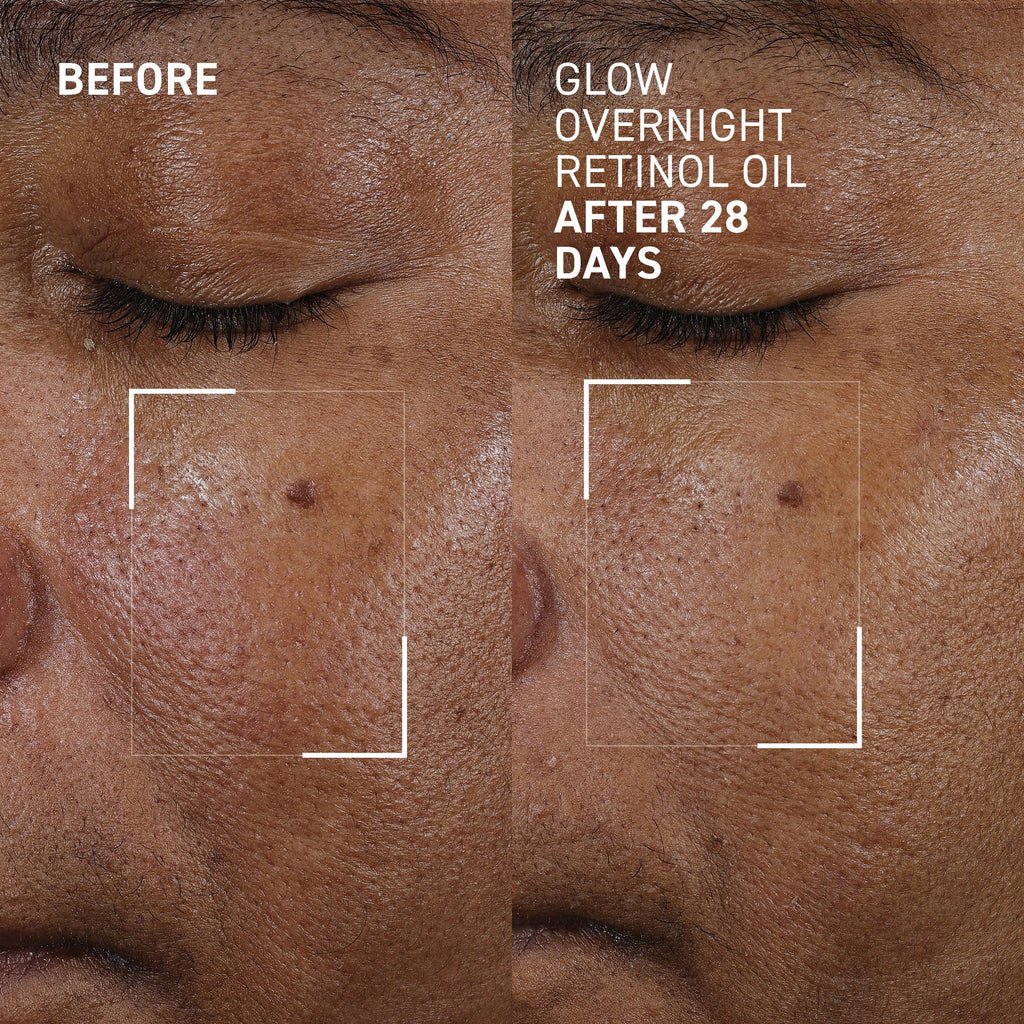 Glow Overnight Retinol Oil