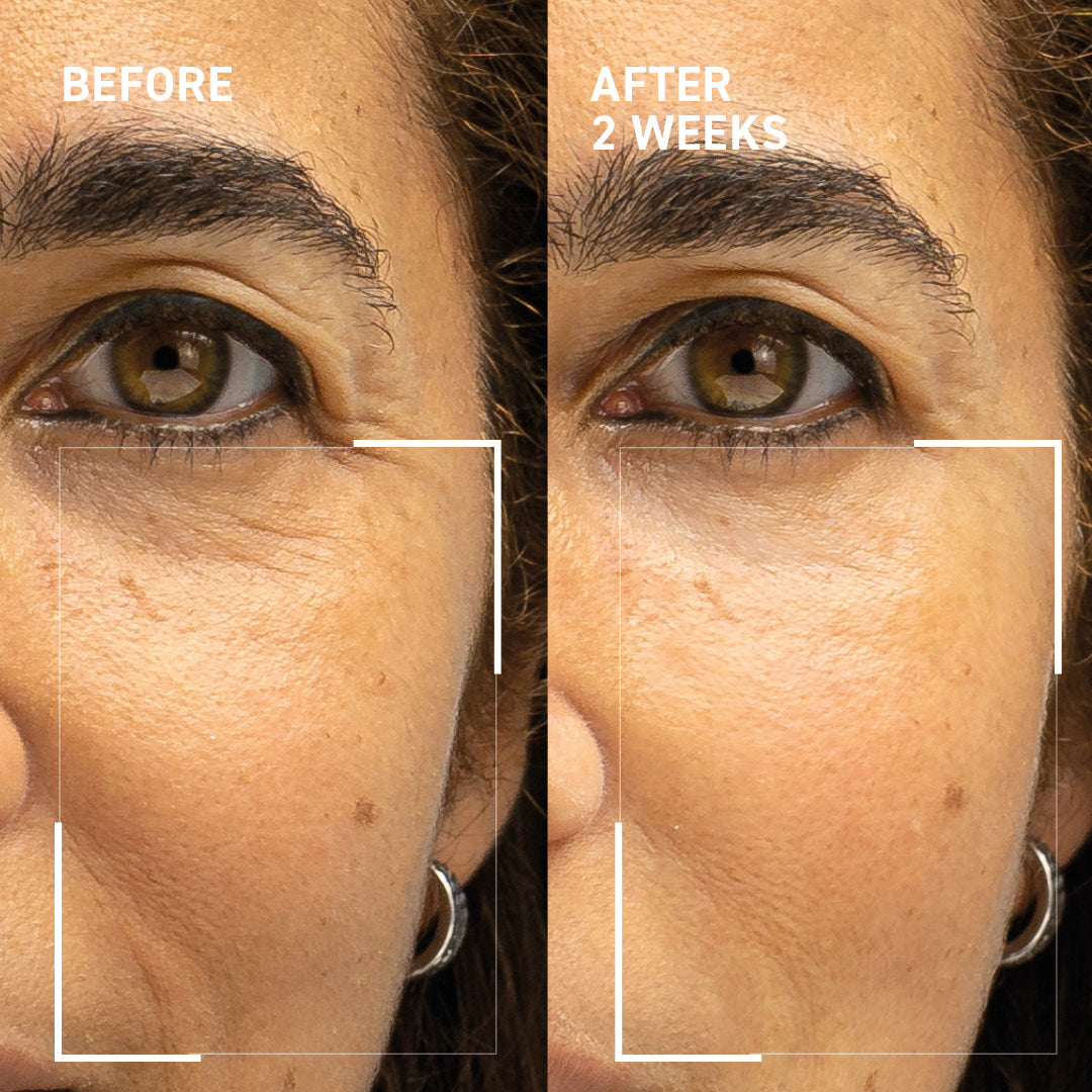 Collagen Support Kit