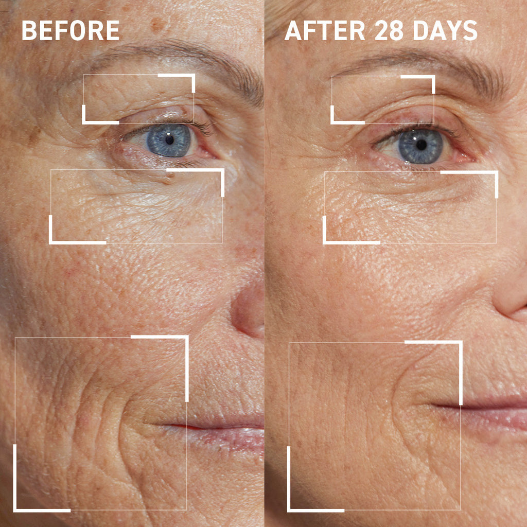 Collagen Support Kit