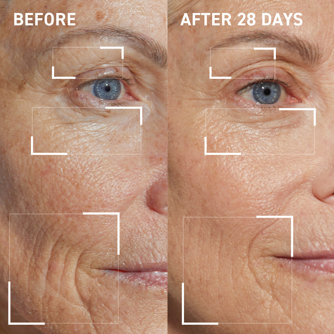 Collagen Support Kit