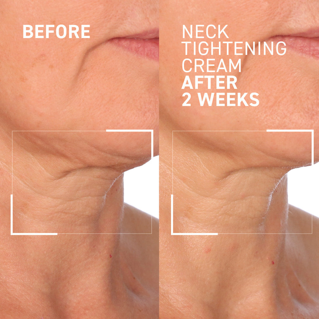 Face & Neck Lifting Duo