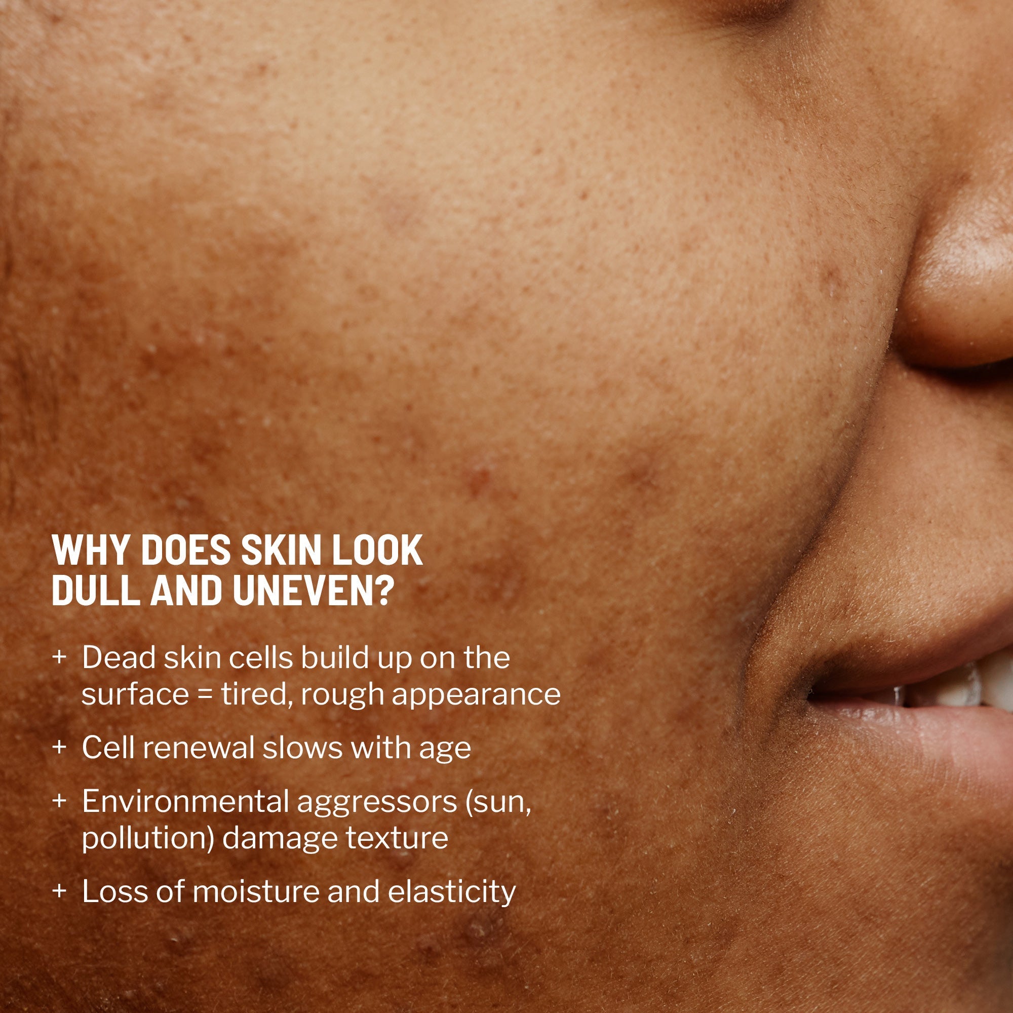 Advanced Microdermabrasion Face Exfoliator
