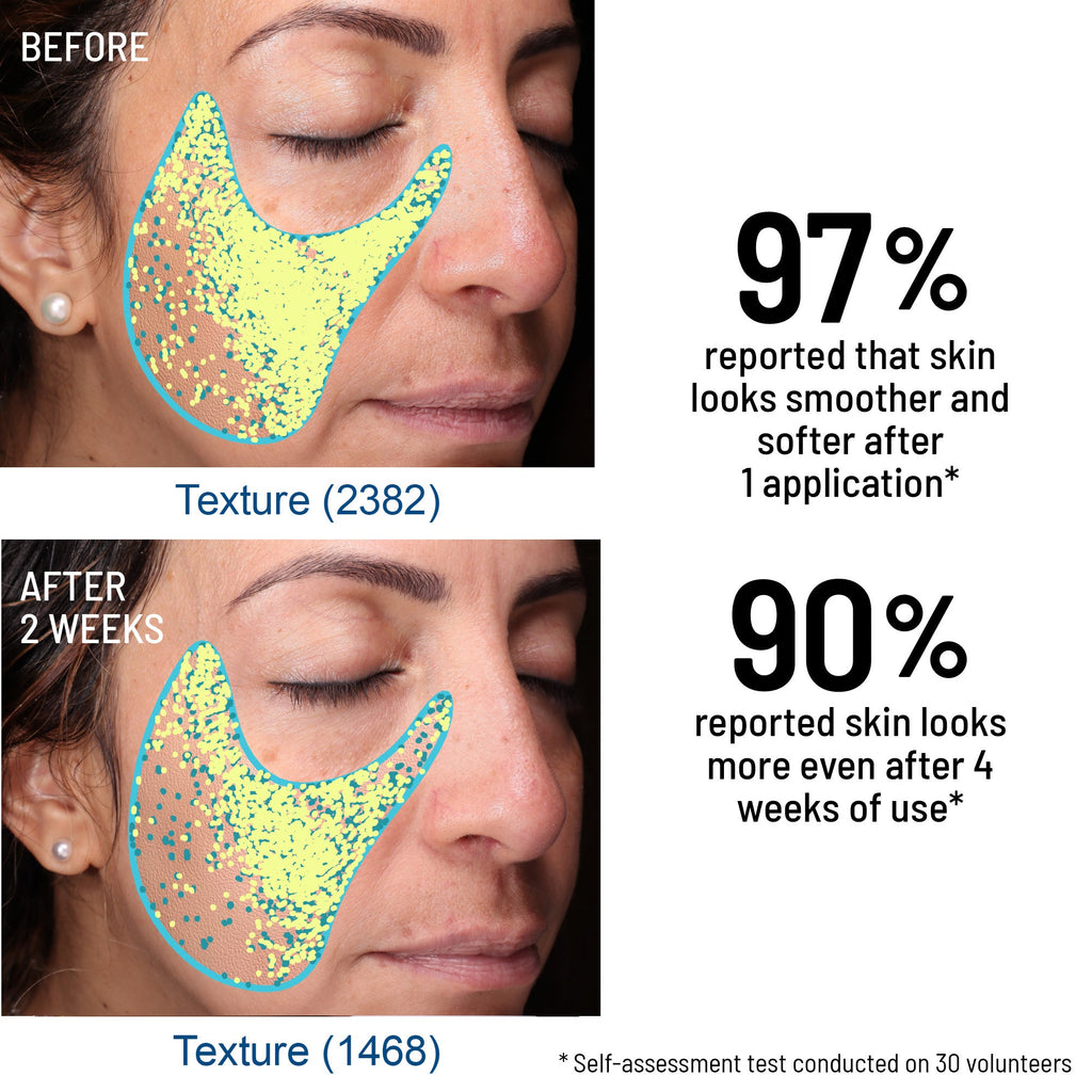 Advanced Microdermabrasion Face Exfoliator