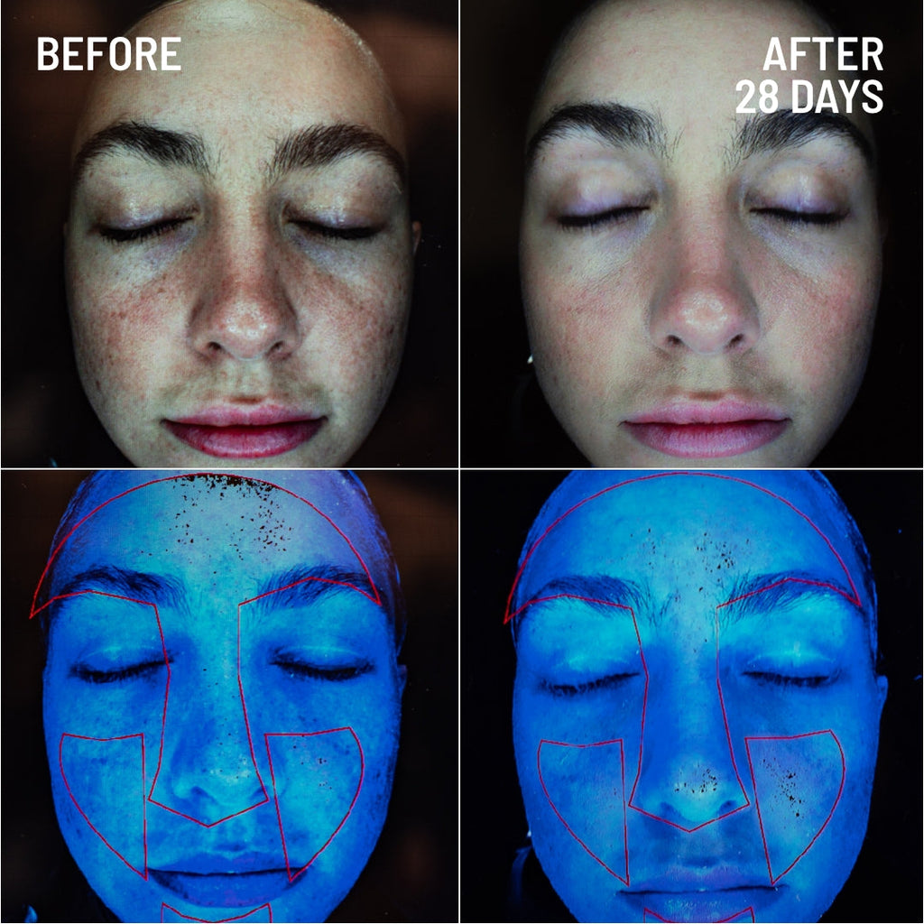 Gentle Microdermabrasion Face Exfoliator