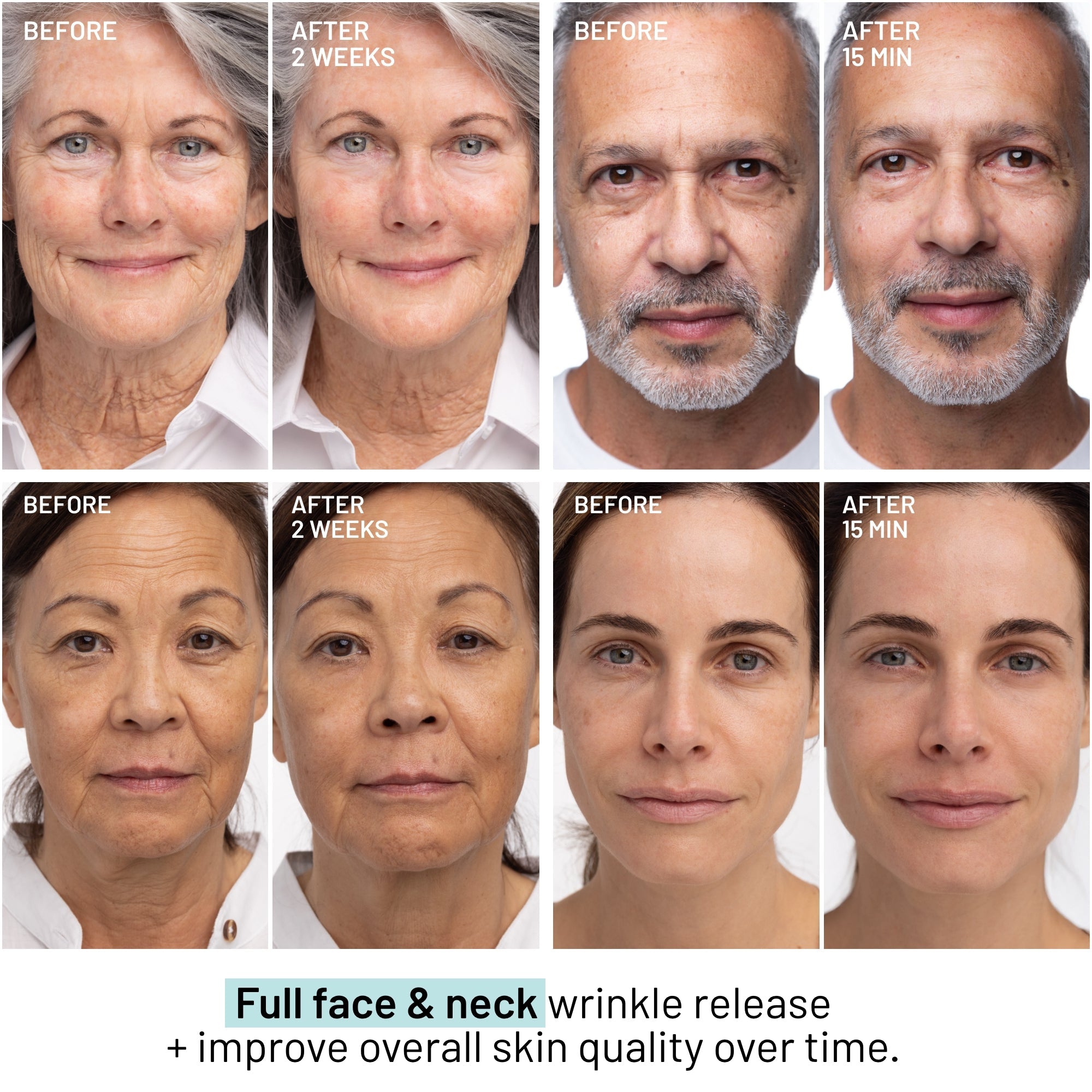 Wrinkle Release Serum