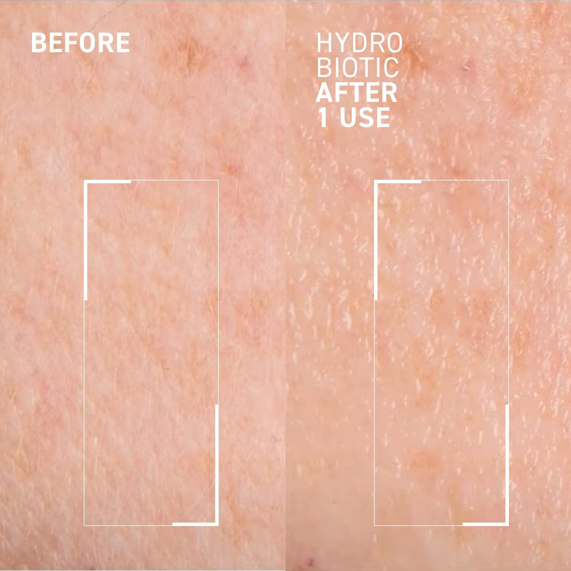 Hydro Biotic