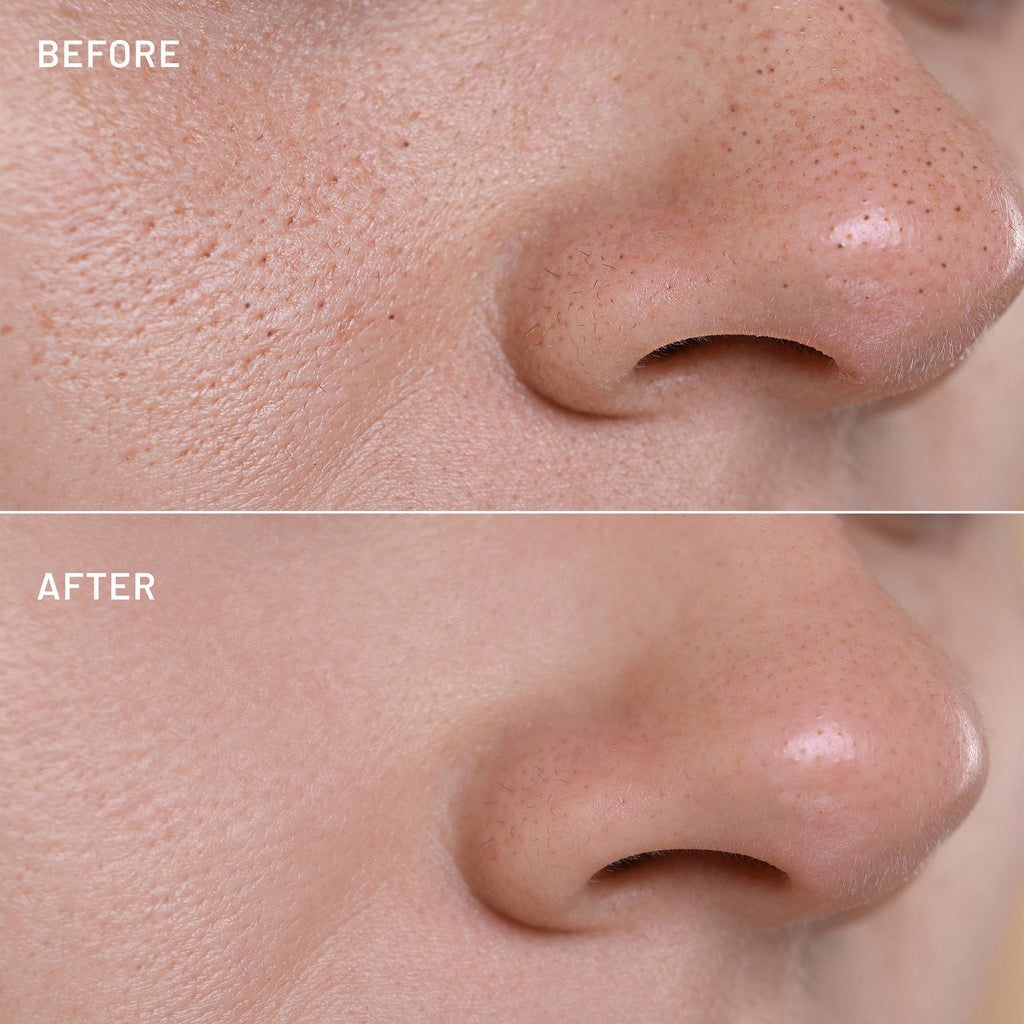 The Pore-Fect Set