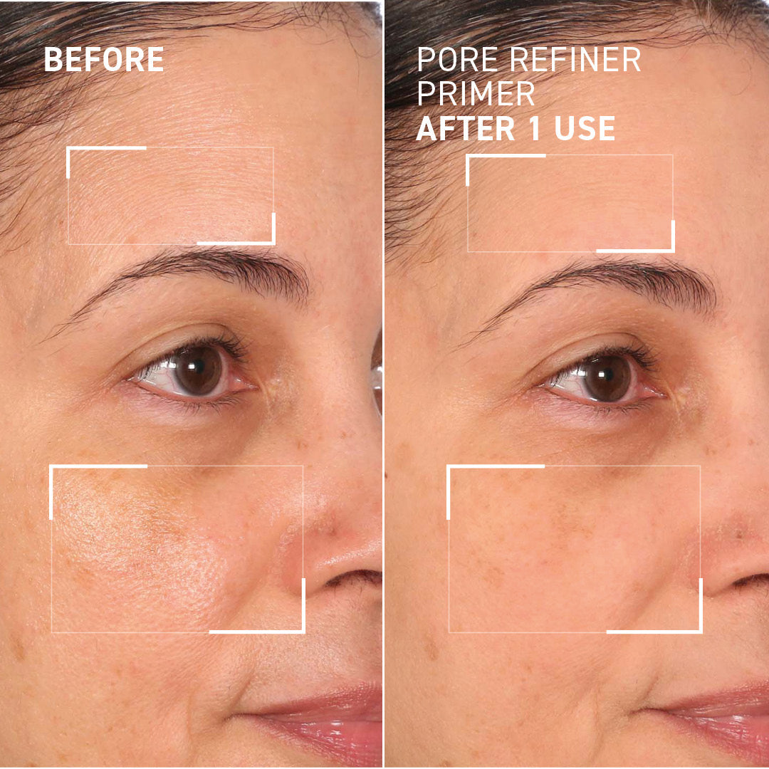 Depuffing & Pore Refining Duo