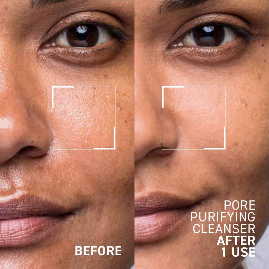 4-in-1 Instant Results Kit