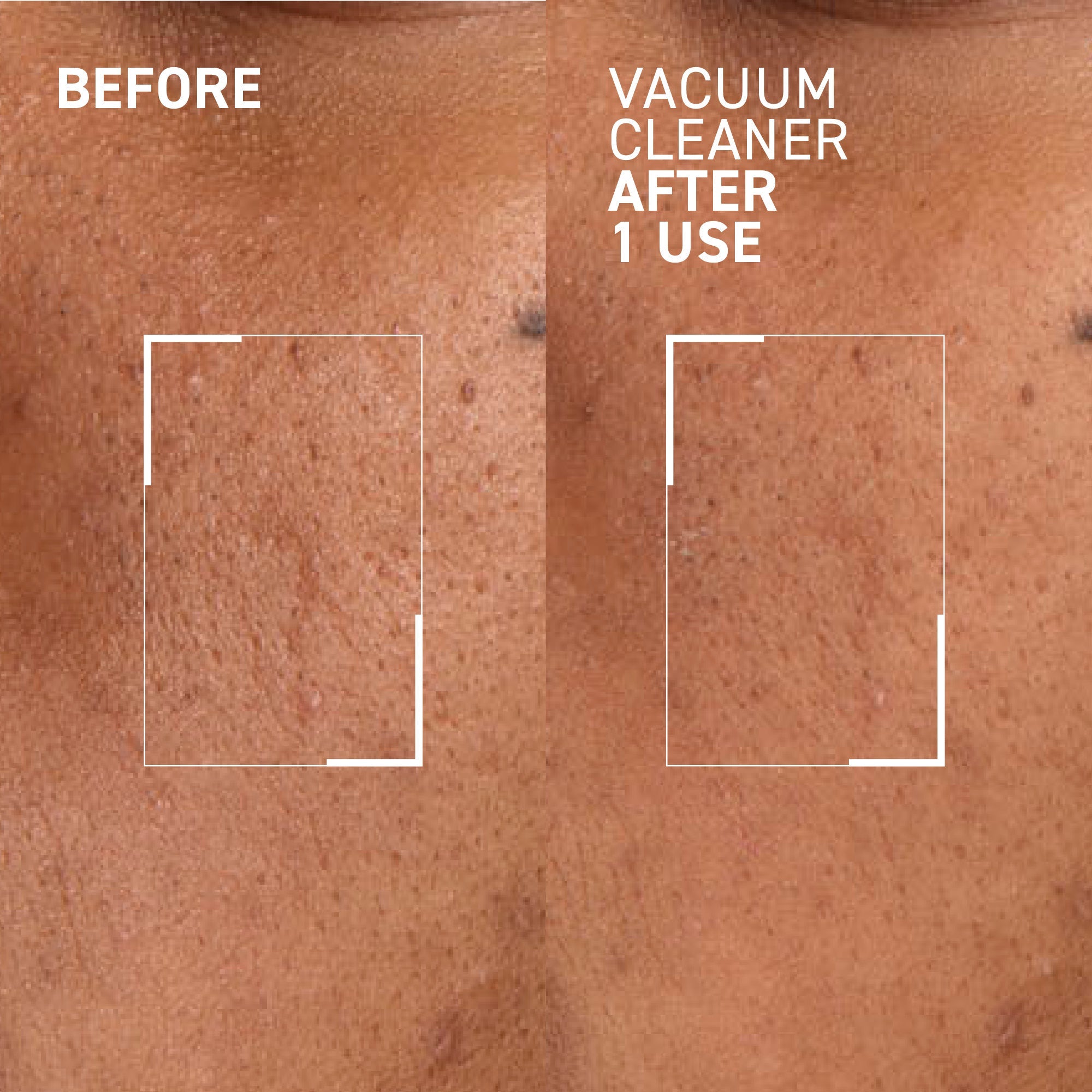 Vacuum Cleaner