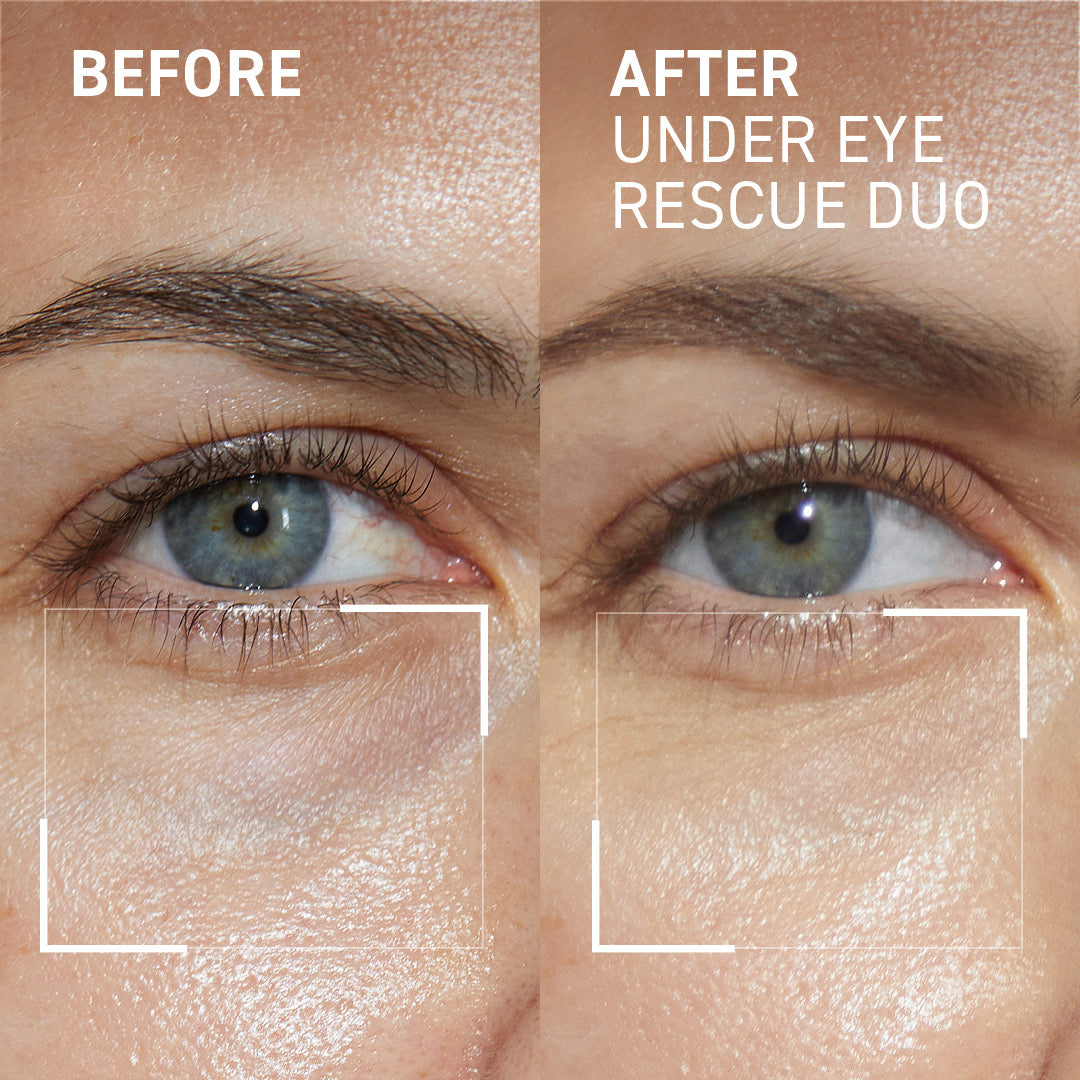 Eye Puffiness & Fatigue Duo