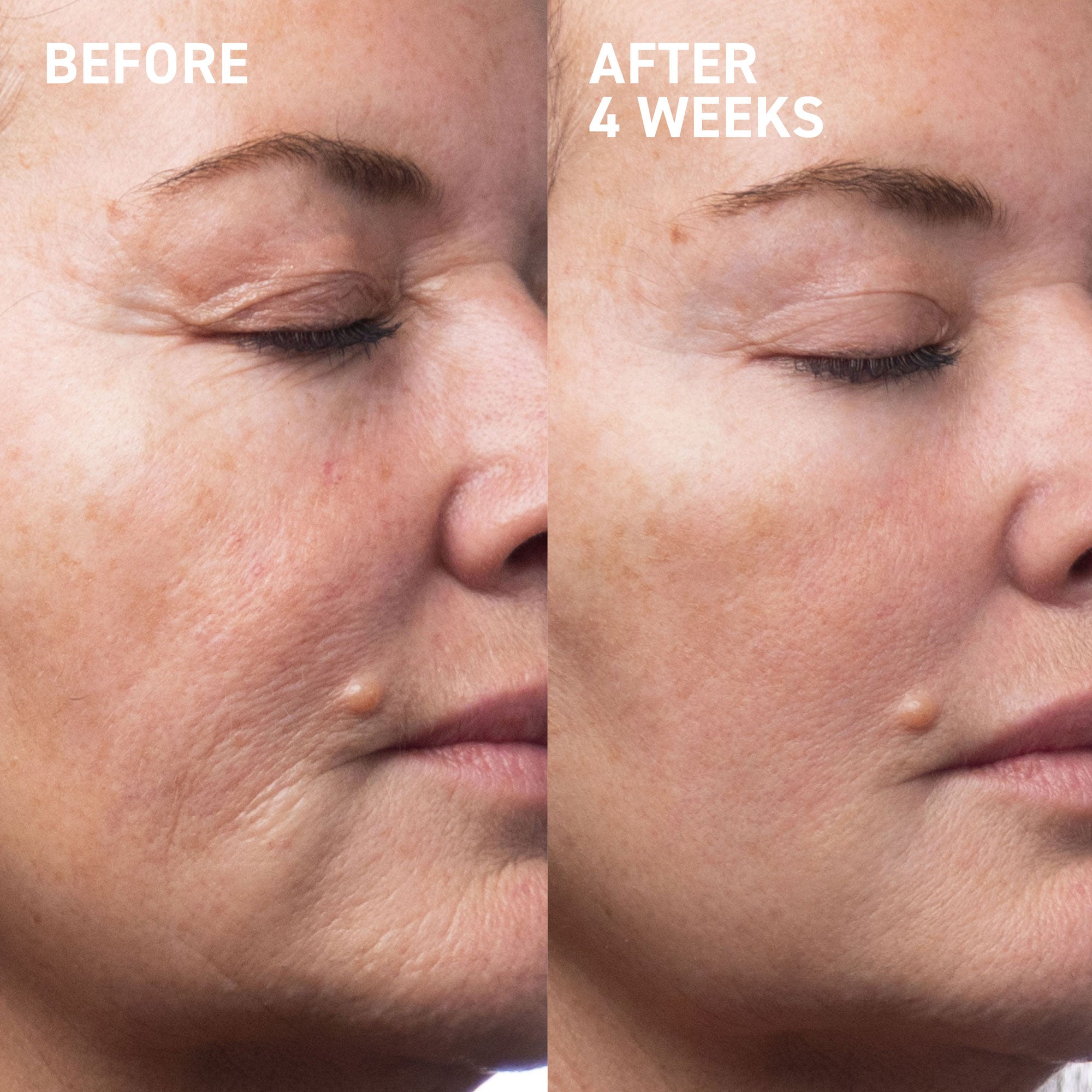 Wrinkle Free Duo