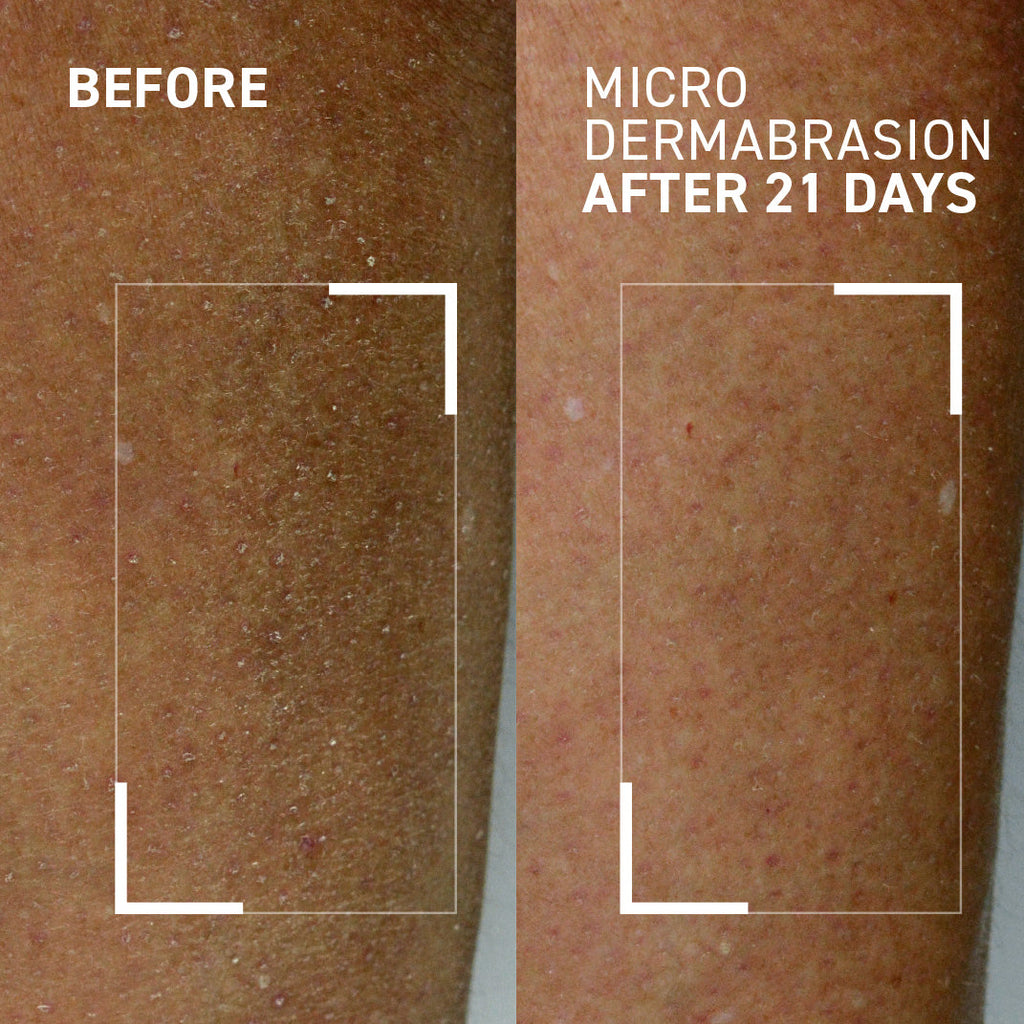 Body polishing exfolitor before and after
